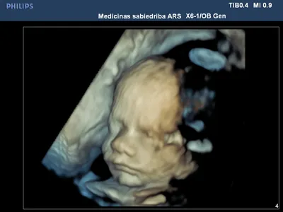 Видео УЗИ. 20 недель беременности. Пол ребенка. | Мама на всю голову | Дзен