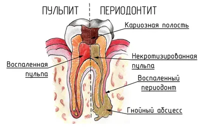 Симптомы: Увеличение лимфоузлов - Доктор Комаровский - YouTube