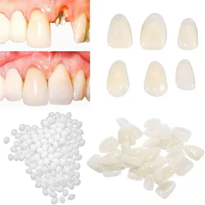 Стоматологический материал, смешанные зубы, временные молярные задние  виниры, зубы, стоматологический инструмент, зубные зазоры, сплошной клей,  клей для зубных протезов - купить по выгодной цене | AliExpress