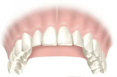 Если болит зуб после установки временной пломбы