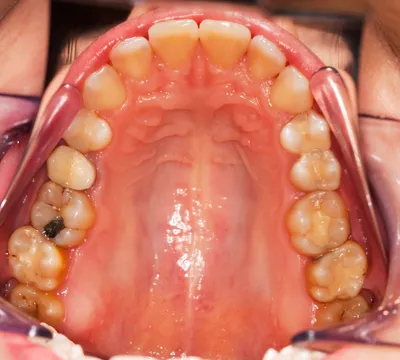Болезни зубов: все, что нужно знать пациенту стоматолога