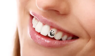 Снятие зубных украшений - Стоматология Северное Бутово Делия только  качественные услуги