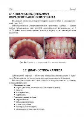 Иллюстрация 7 из 21 для Стоматологические заболевания. Учебник - Марина  Миронова | Лабиринт - книги. Источник: Лабиринт