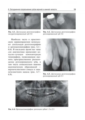 Иллюстрация 1 из 5 для Болезни прорезывания зубов. Учебное пособие ВУЗ -  Эрнест Базикян | Лабиринт - книги.