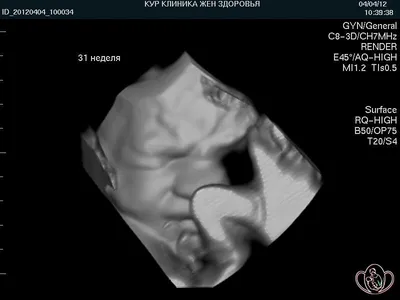 УЗИ плода: можно рассмотреть даже лицо малыша — Медицинский центр «Целитель»
