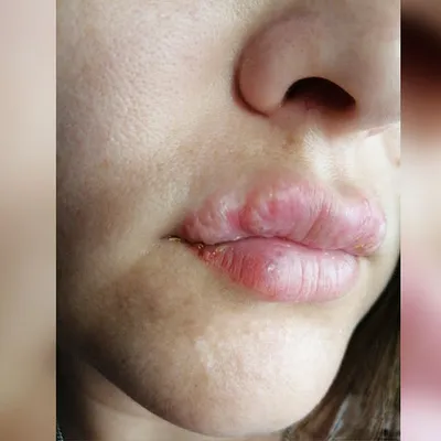 Всю процедуру было больно»: жительница Башкирии хотела татуаж, а получила  искалеченные губы - KP.RU
