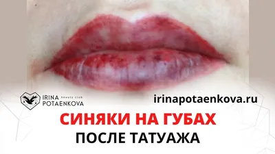 Синяки на губах после татуажа? Почему? - YouTube