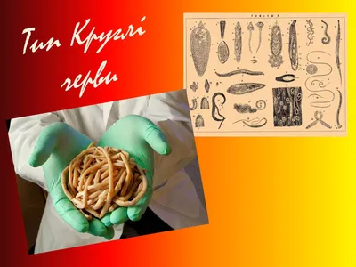 Презентация по теме Тип Круглые черви — презентации по биологии | GDZ4YOU