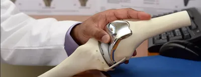 Разрыв заднего рога медиального мениска коленного сустава - OrtoMed Clinic