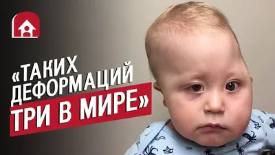 У моего сына деформация черепа: Таня | Быть мамой - YouTube