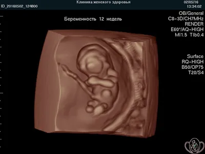 УЗИ беременности в Одессе: 3Д и 4Д УЗИ плода | Медицинский дом Odrex