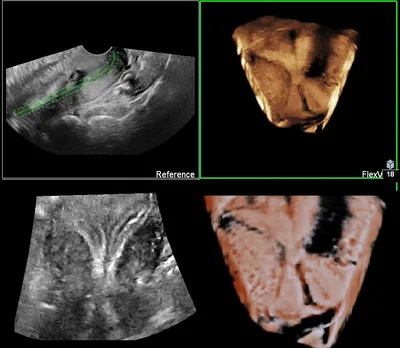 УЗИ 3D и 4D при беременности – Другие методы диагностики – диагностическое  отделение в МЦОЗ