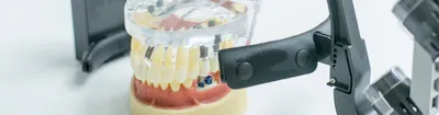 Виды протезирования передних зубов
