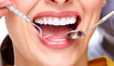 Шинирование зубов стекловолокном в стоматологии Днепр | ДентАрт