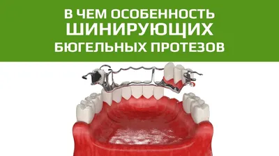 Шинирование зубов стекловолокном – цена в Москве