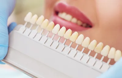 Как восстановить зуб