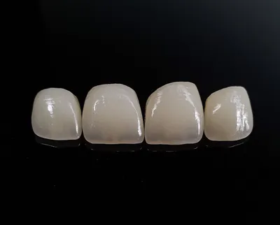 Услуги Безметалловая керамика стоматология по низкой цене в Черкассах