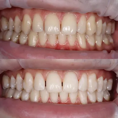 Здоровые зубы и белоснежная улыбка — это красиво и модно. | SMAGA dental  clinic