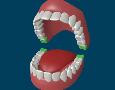 Больно ли удалять зуб мудрости: особенности, проблемы, вопросы и ответы
