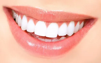 Почему зубы теряют белизну - советы стоматолога