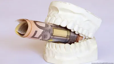 Как немцы лечат зубы – DW – 06.03.2019