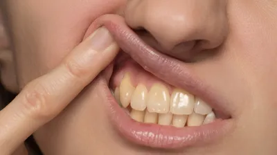Почему желтеют зубы и как это исправить? - t-stom.kiev.ua