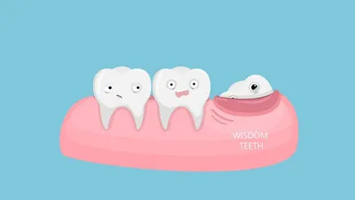 Зубы мудрости - все что нужно знать об этом типе зубов - стоматолог