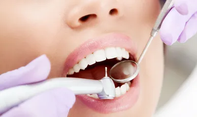 Лечение зубов - цены в Каневской