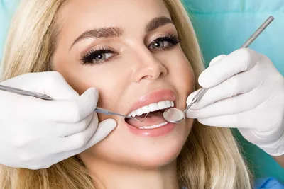 Накладки на зубы: цены и виды зубных накладок на передние зубы в  стоматологии Estetica Dent