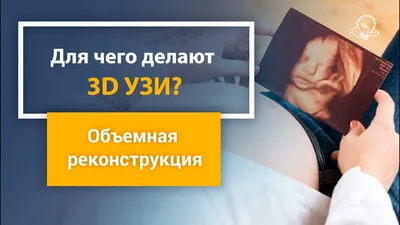 3D/4D УЗИ плода при беременности и органов в Твери