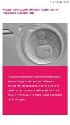 ЭКО в Корее с Вероникой ekovkoree@bk.ru тел.(WhatsApp): +82-10-5208-1368:  3-х или 5-и дневные эмбрионы. В чем разница?
