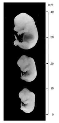 Почему перенос эмбриона лучше делать именно на 5-й день развития? —  Reprolife