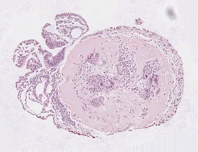 ПРОТОКОЛ. Выделение мышиного эмбриона