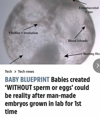 Без спермы и яйцеклетки: ученые вырастили полную модель человеческого  эмбриона, неотличимую от настоящего