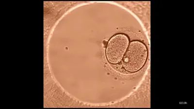 Клиника ЭКО «Линия Жизни» on Instagram: \"Чаще всего будущим ЭКО-мамам  переносят эмбрион пятого или шестого дня развития. На 5-6 день пребывания в  инкубаторе эмбриончики достигают стадии бластоцисты. Эта стадия открывает  возможность наиболее