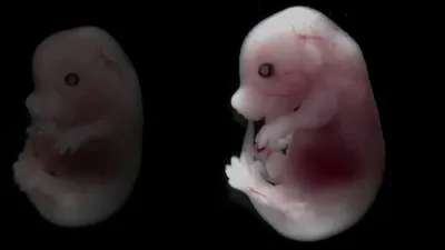 Эмбрион в печени: врачи зафиксировали редкий случай внематочной  беременности — Курьезы