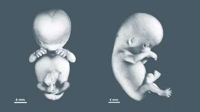 Ученые превратили стволовые клетки в эмбрионы — как такое возможно? -  Hi-News.ru