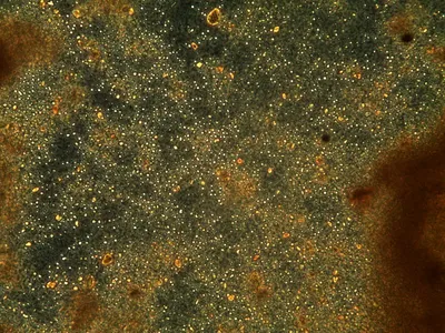 Как выглядят какашки под микроскопом | Гистология за 3 минуты - YouTube