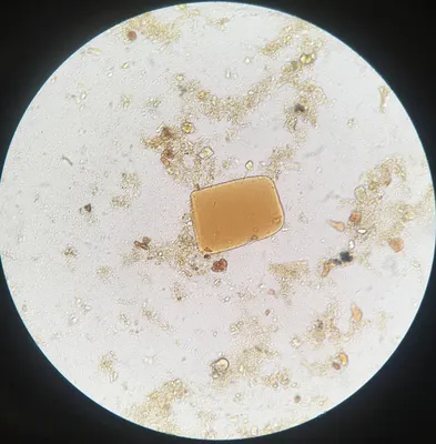 Лабораторная диагностика. Микроскопия | Пикабу