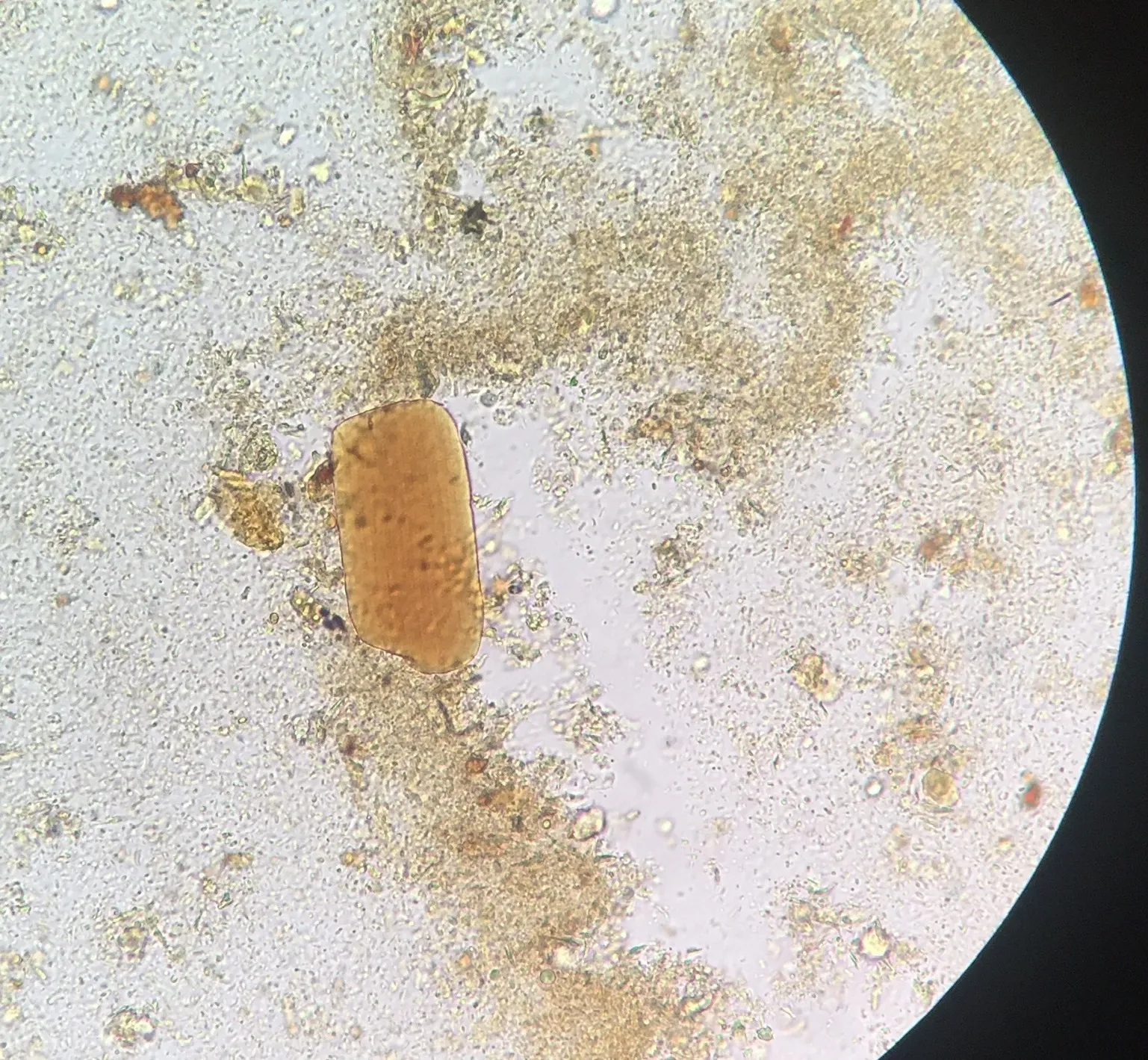 Растительная клетчатка в копрограмме. Копрология кала микроскопия. Микроскопия кала копрограмма. Микроскопия копрограммы.