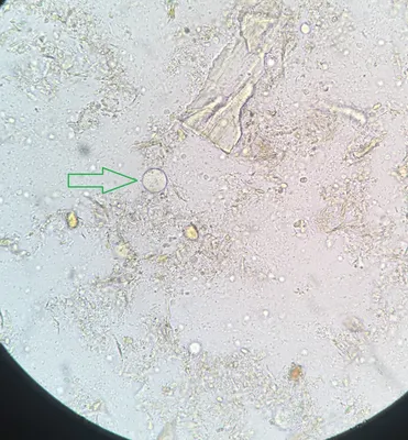 Лабораторная диагностика. Микроскопия | Пикабу