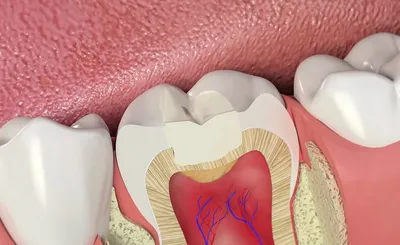 После посещения стоматолога каждому человеку хочется знать, как же долго  прослужит пломба?