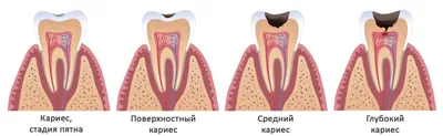 Лечение зубов - Marident