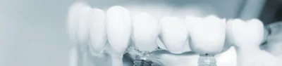Клинические рекомендации при диагнозе кариес зубов - Стоматологическая  ассоциация Санкт-Петербурга