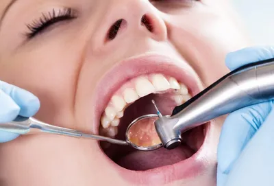 Лечение кариеса зубов - цена, отзывы