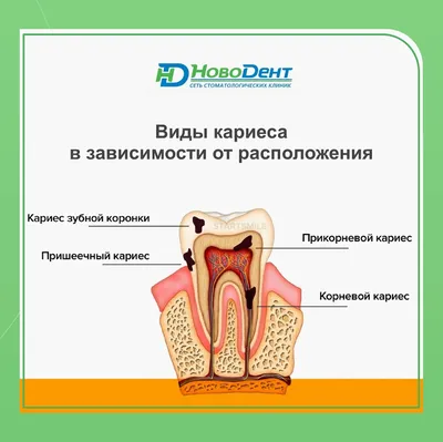 Срочно к врачу! — НовоДент - сеть стоматологий