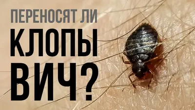 Переносят ли клопы ВИЧ и могут ли заразить человека СПИДом? - YouTube