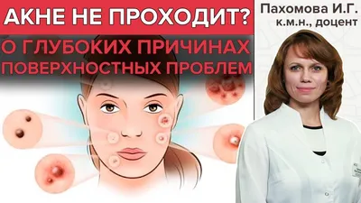 Акне Кожные заболевания Skin Life Аптека Te Puke Waikare, режим купания,  крем, лицо, спина человека png | PNGWing