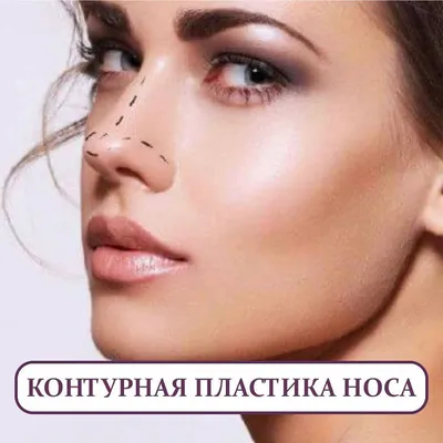 Пластика носа в Алматы | Центр косметологии JanelProff