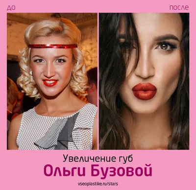 Ольга Бузова до и после увеличения губ